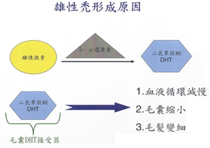 雄性禿頭形成原因